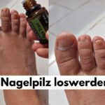 Nagelpilz mit ätherischen Ölen loswerden